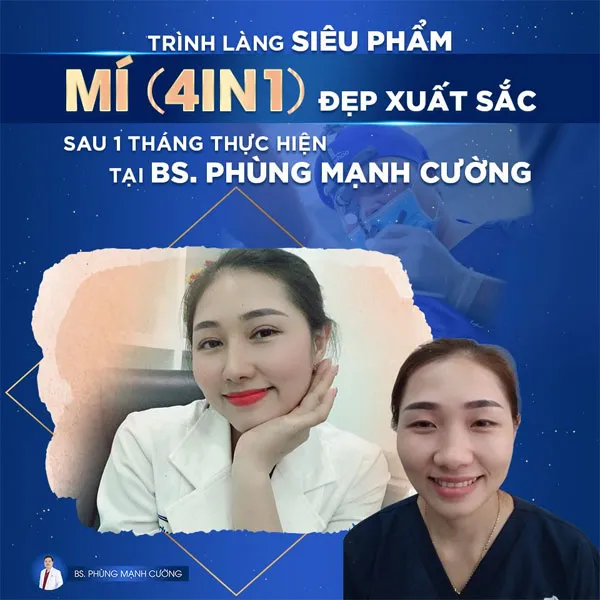 Bác Sĩ Hướng Dẫn Cách Làm Tan Máu Bầm Ở Mí Mắt