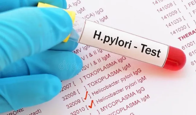 H.pylogi IgG - IgM (test nhanh)