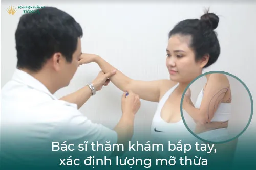 Quá trình thăm khám bắp tay, xác định vùng mỡ thừa