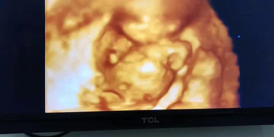 Hình ảnh siêu âm bộ phận sinh dục Be trai